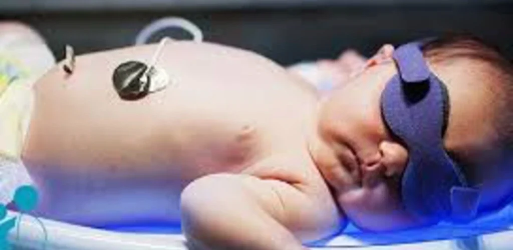 چه زمانی زردی نوزاد خطرناک است|؟