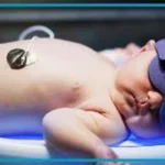 چه زمانی زردی نوزاد خطرناک است|؟