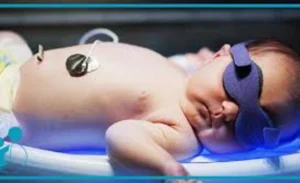 چه زمانی زردی نوزاد خطرناک است|؟