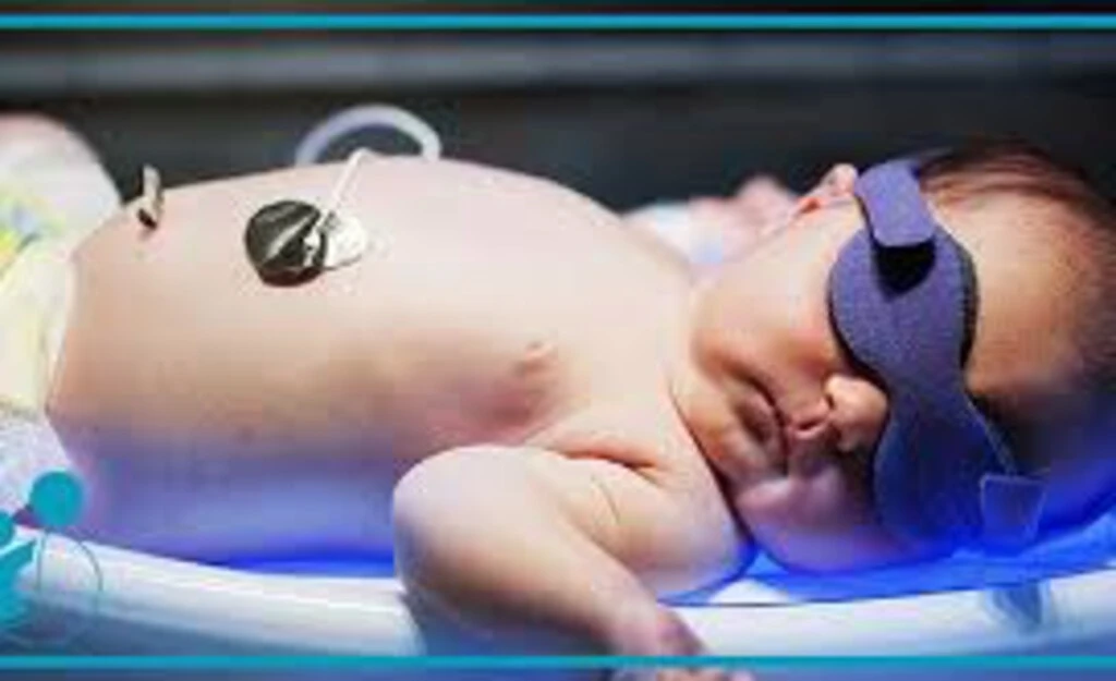 چه زمانی زردی نوزاد خطرناک است|؟
